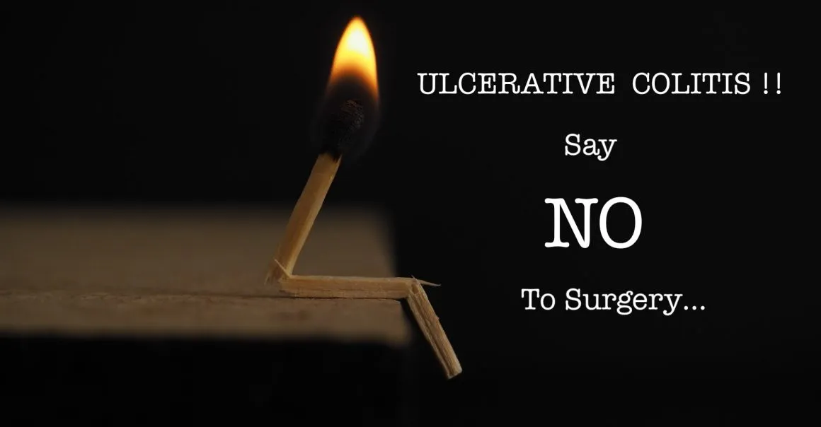 Ulcerative Colitis Treatment