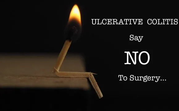 Ulcerative Colitis Treatment