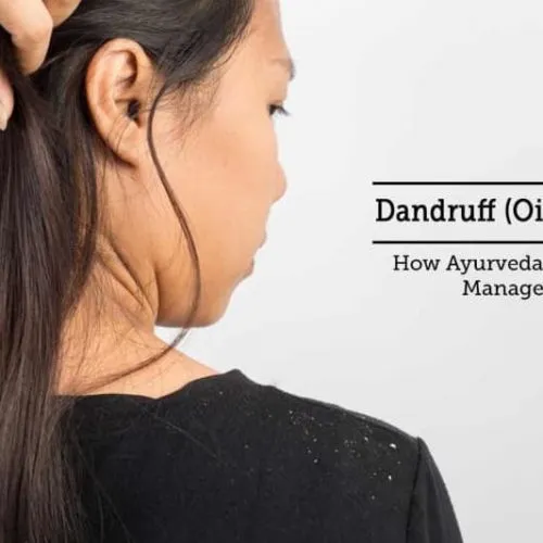56436498_1634353416667655_1425421378353364992_n (1) Dandruff(Oily & Wet)